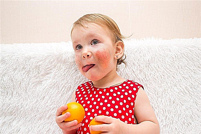 Alergie na mandarinky